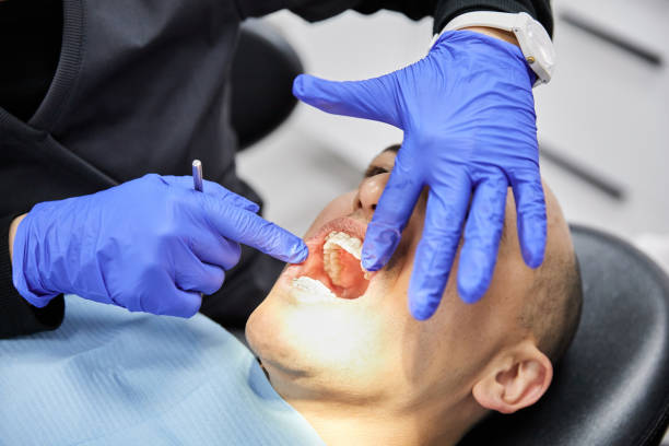 Best Emergency Treatment for Toothache in Rosedale, WA