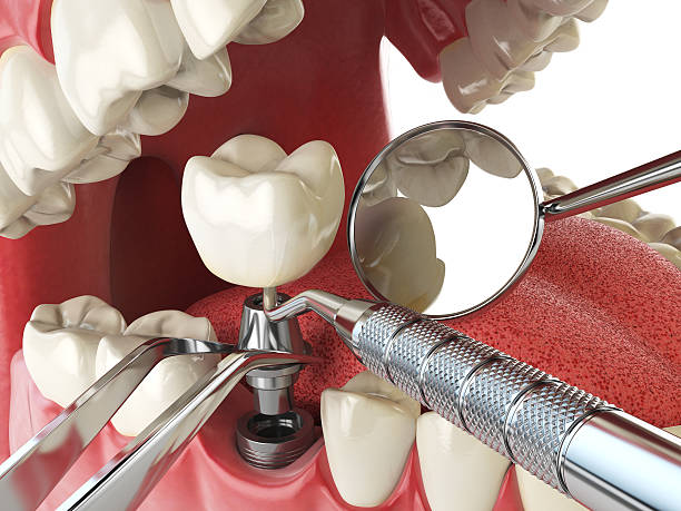 Best Emergency Orthodontic Repairs in Rosedale, WA